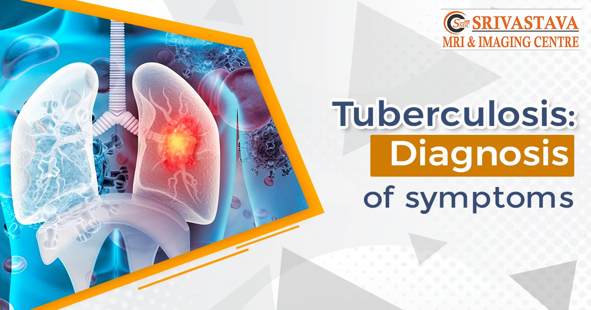 Tuberculosis: Diagnosis of symptoms – srivastavamriandimagingcentre