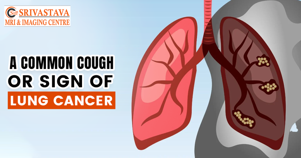 A COMMON COUGH OR SIGN OF LUNG CANCER Srivastavamriandimagingcentre