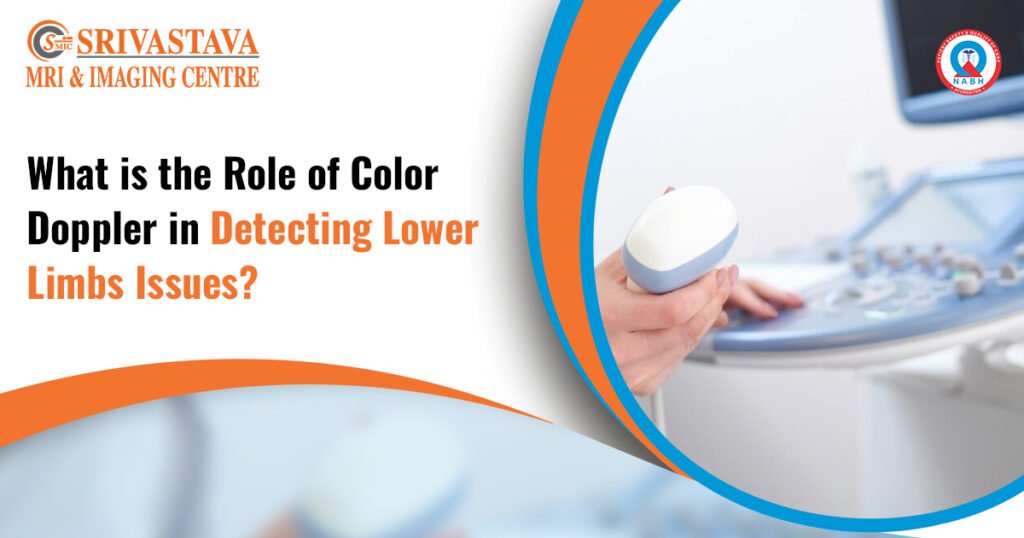 Best Color Doppler Centre Test in Kalkaji