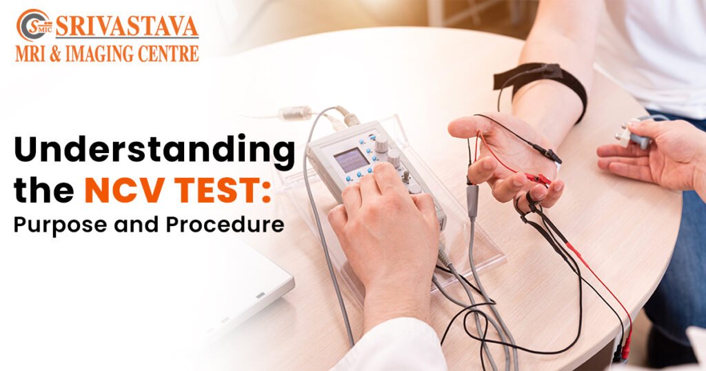 Understanding The Ncv Test Purpose And Procedure