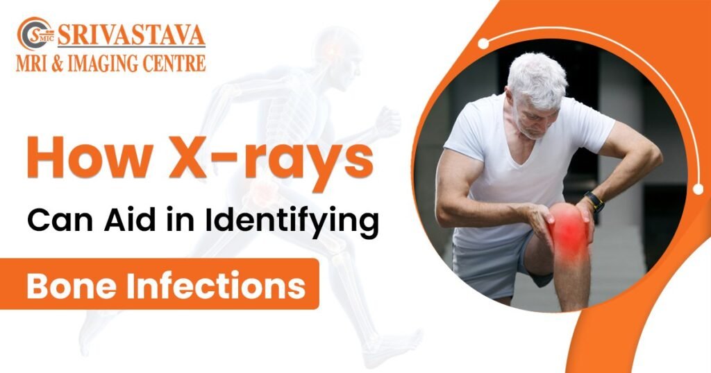 Best X-Ray Centre in Noida