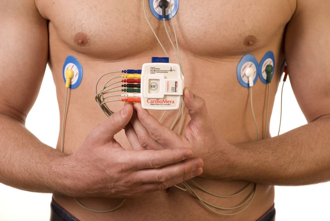 Best HOLTER Test Centre in Delhi